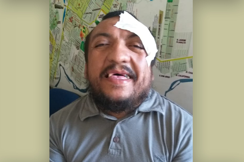 Parauapebas: Guardador de carros é agredido dentro de loja