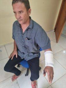 “Pororoca”, apenas com lesão no braço esquerdo, fugiu sem prestar ajuda / Foto: Divulgação