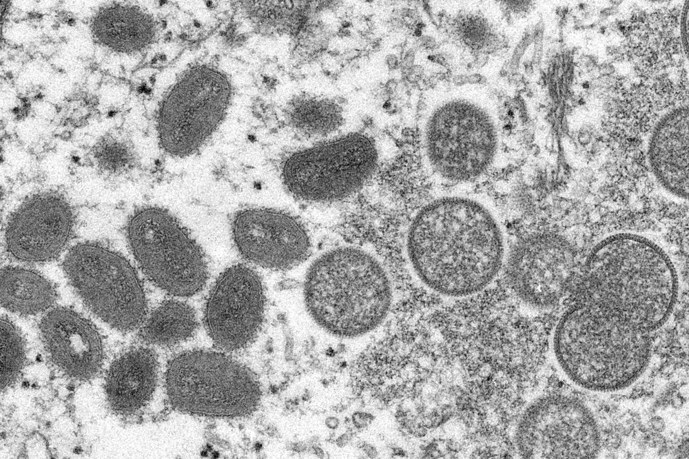 Varíola dos macacos: OMS dá novos nomes às variantes do vírus