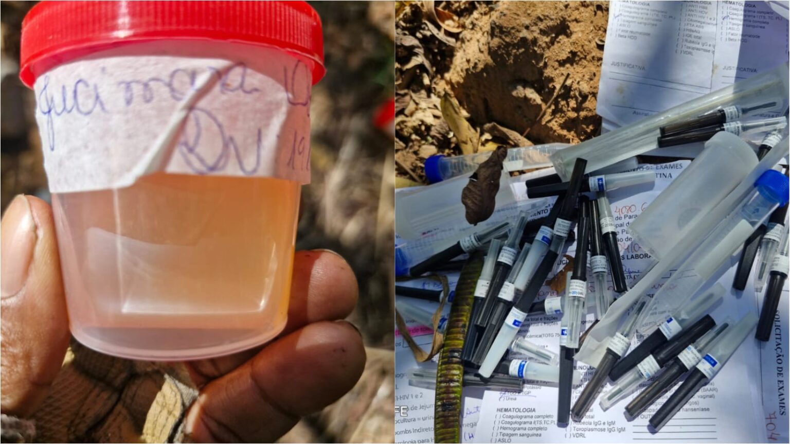 Parauapebas: moradores denunciam descarte irregular de material biológico