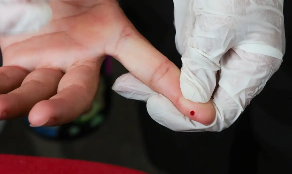 Mão com luva médica segurando um dedo com gota de sangue para exame.