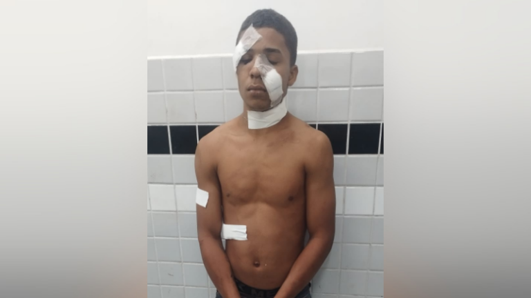Suspeito ataca casal durante invasão e acaba esfaqueado por vítima em Parauapebas