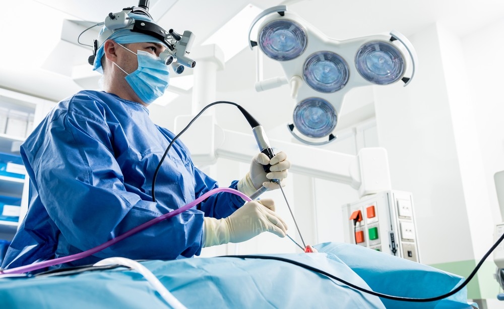 Representação de endoscopia gástrica com destaque para a coleta de suco gástrico para análise de DNA na detecção de câncer de estômago.