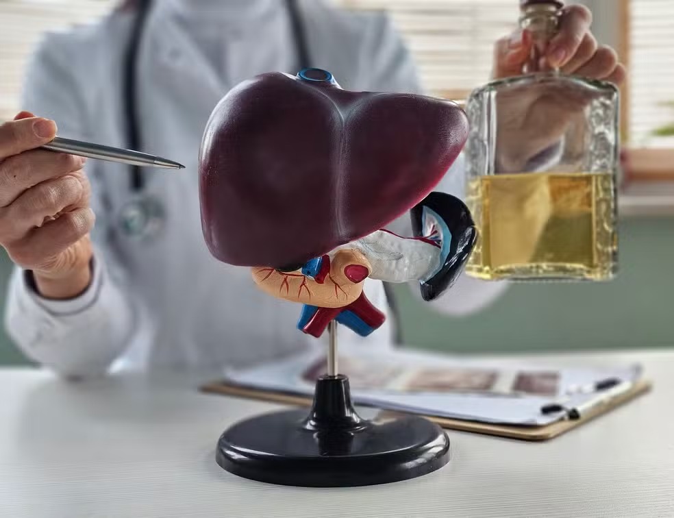 Modelo anatômico do fígado com médico e garrafa de bebida alcoólica.