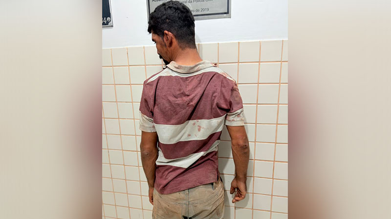 Homem de costas em camisa listrada suja, com marcas nos cotovelos, em frente a uma parede de azulejos.