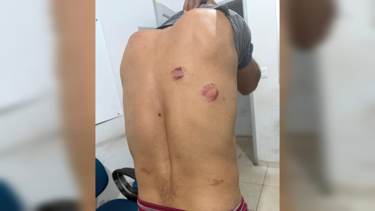 Dois casos de agressões são registrados na noite em São Domingos