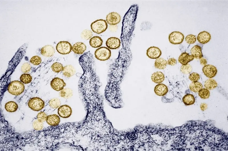 Micrografia eletrônica de vírus HIV brotando de uma célula hospedeira.