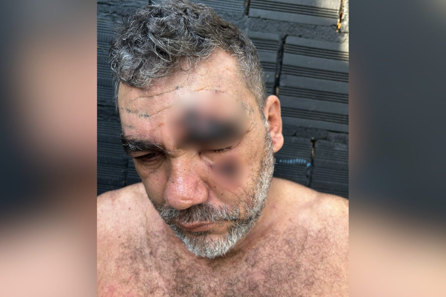 Motorista denuncia que foi torturado por fiscais da Semma em Marabá