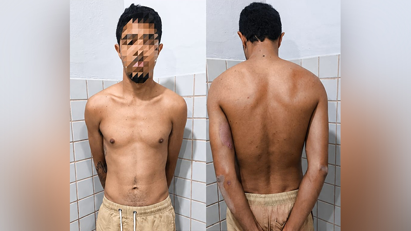 Homem sem camisa em duas vistas, frontal e dorsal, com rosto pixelado.