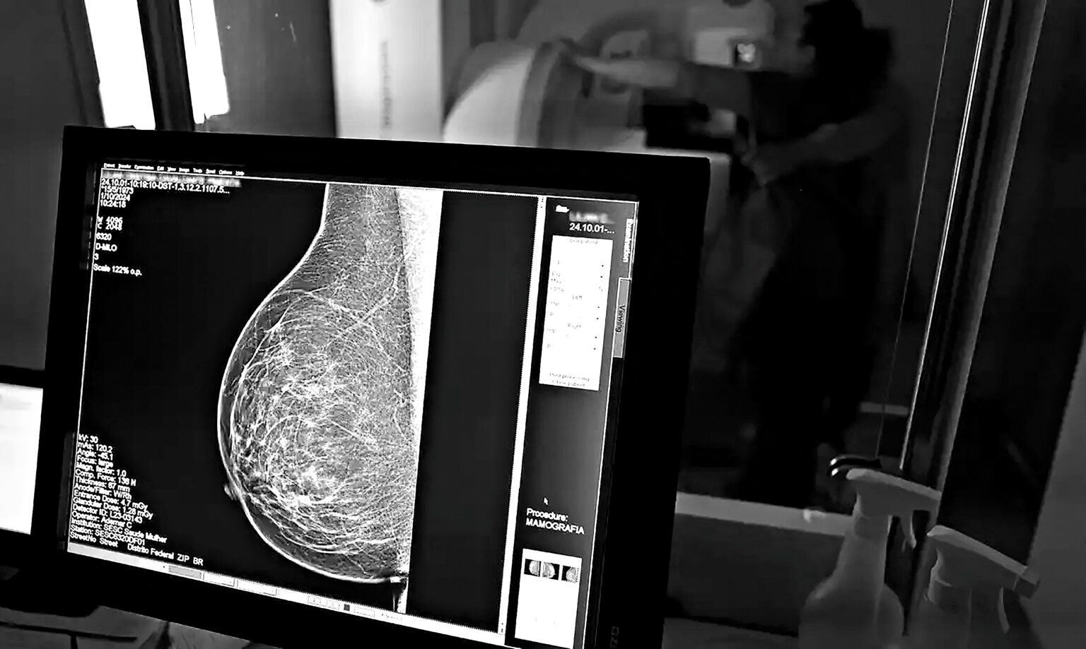 Plano de saúde terá que cobrir mamografia digital para todas as idades