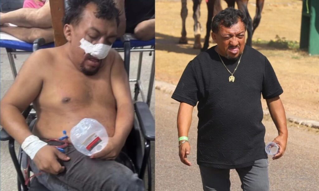 Montagem comparativa mostrando um homem com curativo no nariz à esquerda e o mesmo homem recuperado em um ambiente externo à direita.