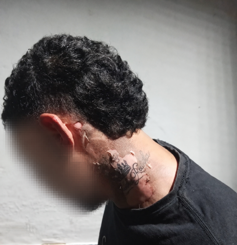 Mulher é detida por queimar homem com óleo quente em Parauapebas